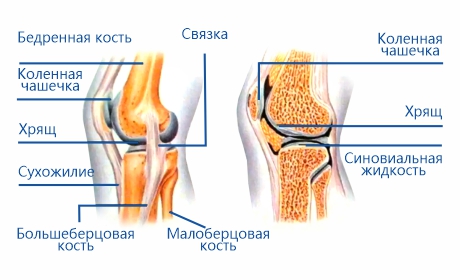 Причины боли в коленях: основные факторы и способы лечения